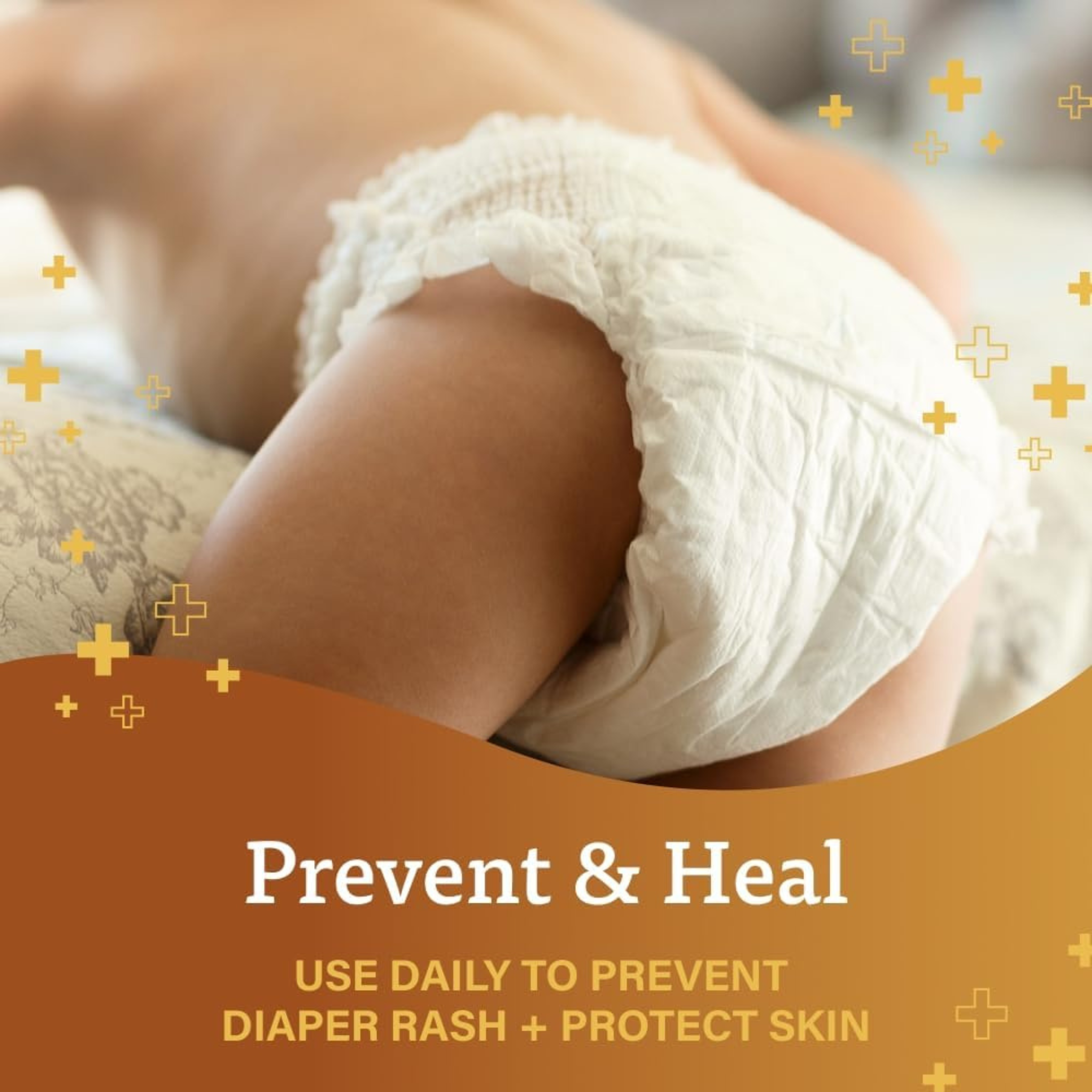 A+D, Original Ointment Diaper Rash, Soothing and Effective Skin Protectant, 1.5 Oz.