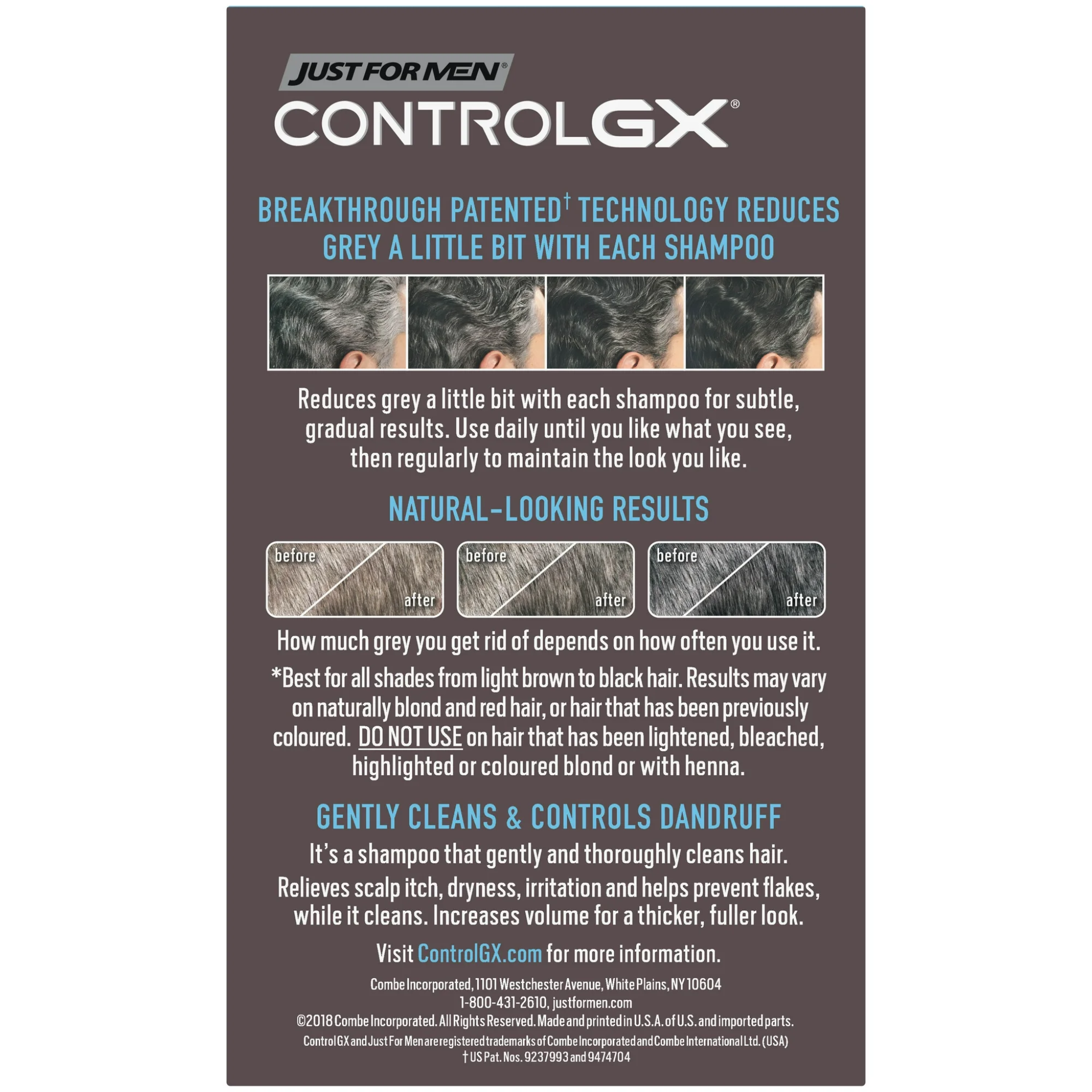 Just For Men, Control GX Grey Reducing Anti-Dandruff Shampoo, Gradually Colors Hair, 4 Fl Oz