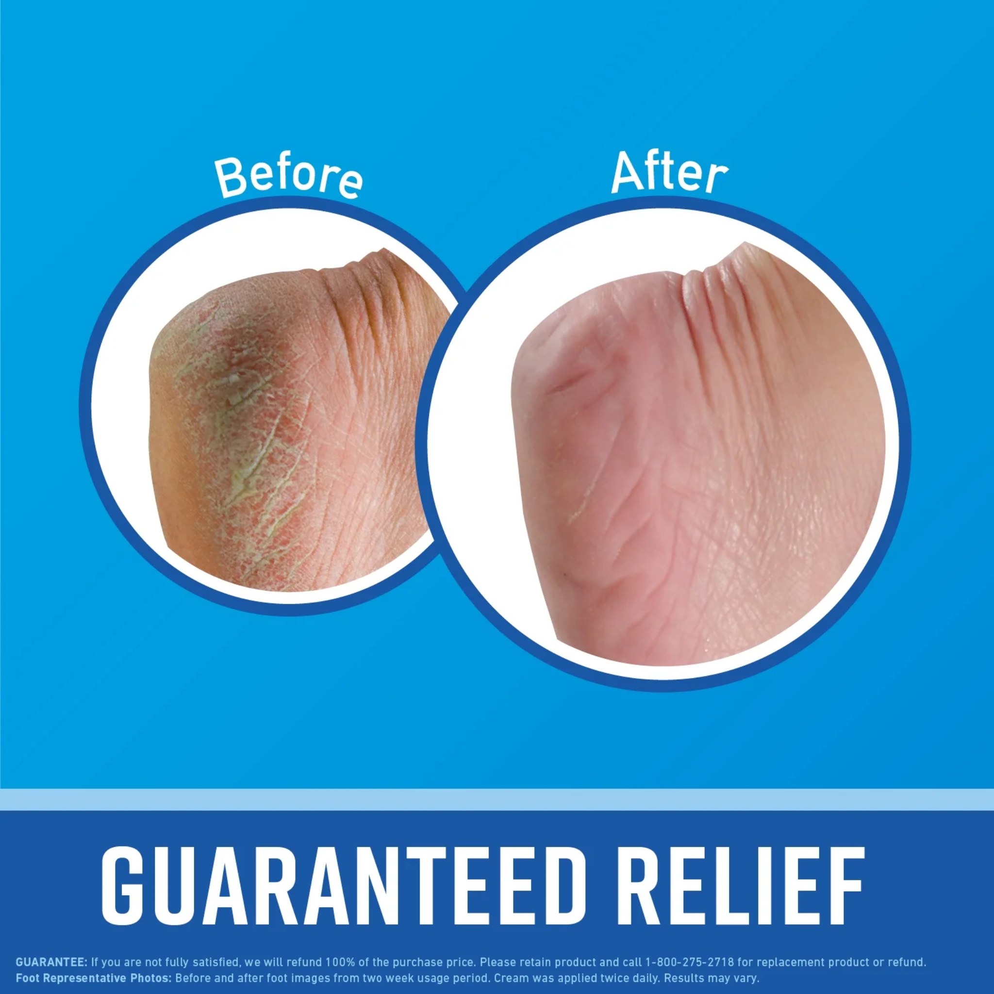 O'Keeffe's, Healthy Feet Cream, Intensive Moisturizing Formula for Extremely Dry, Cracked Feet, 2.7 Oz Jar