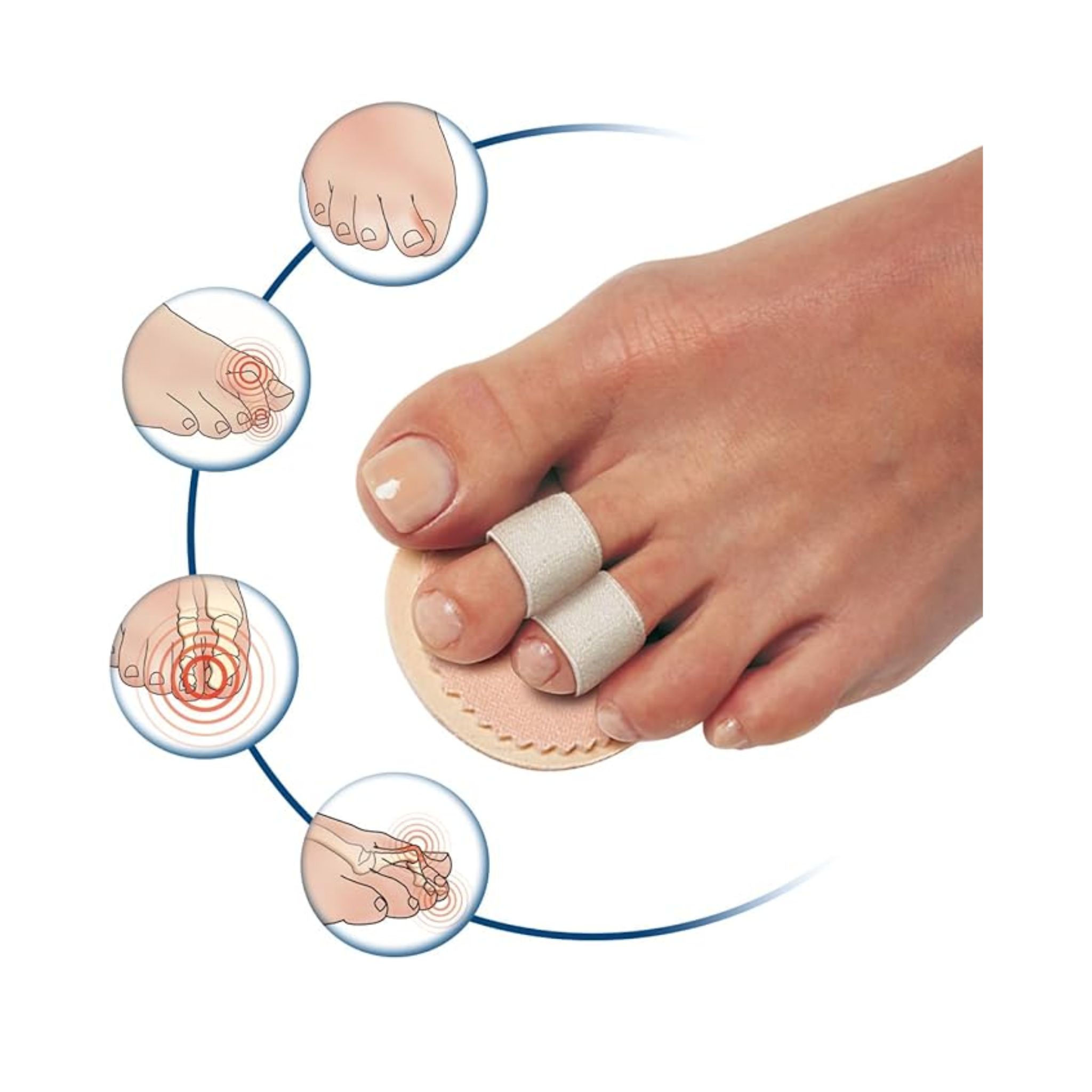 PediFix, Double Toe Straightener, One Size Fits Most for Alignment and Comfort, 1 Each