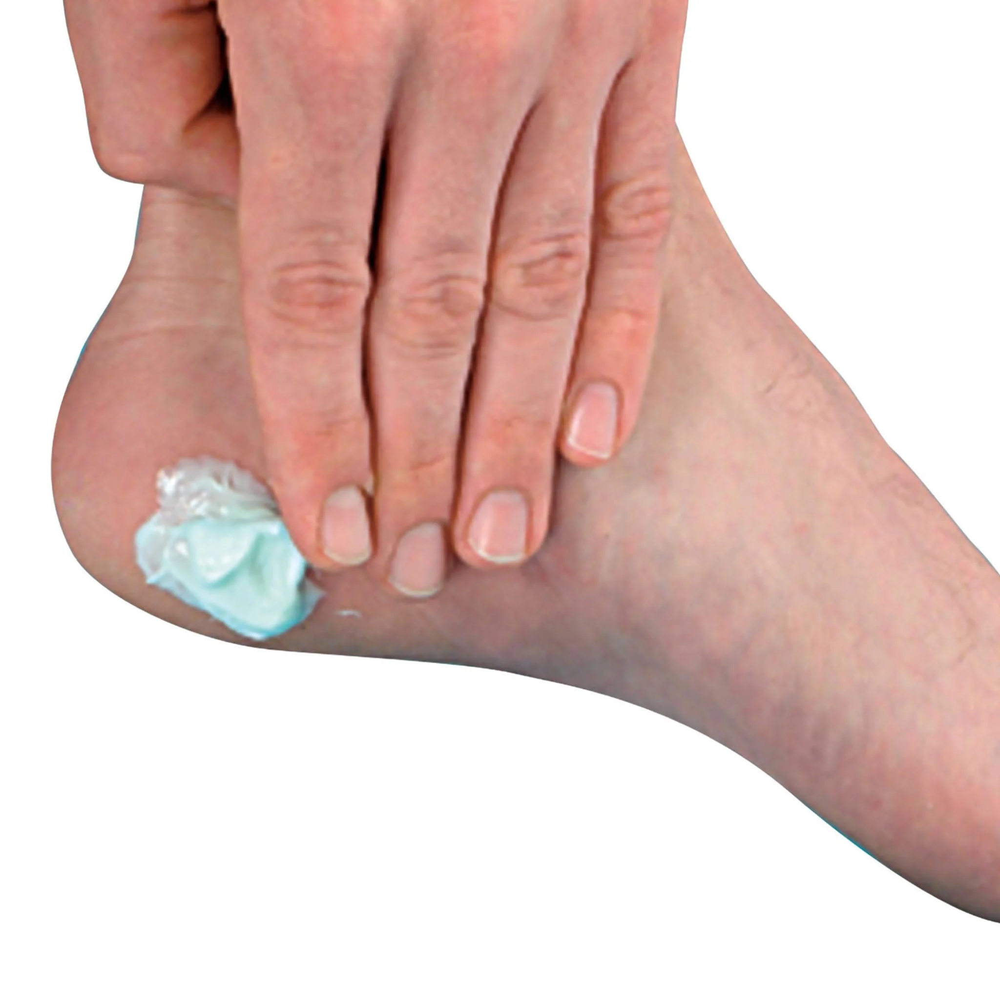 Pedifix, Scented Foot Moisturizer Cream, Nourishing Hydration for Dry Feet, 4 Oz Jar